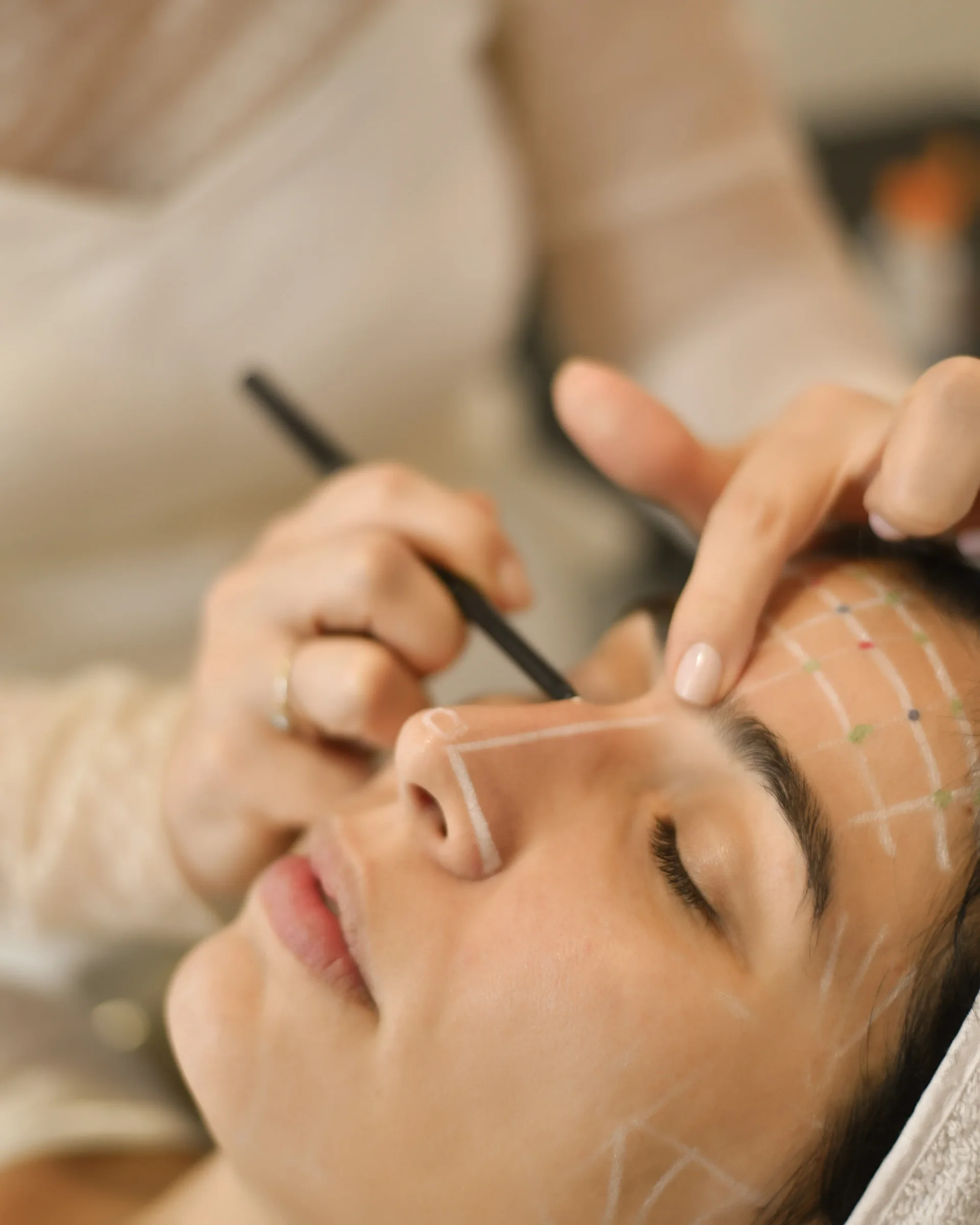 Tratamento para Olheiras - Olheiras podem ter componentes pigmentares, vasculares e estruturais. Avaliação dermatológica e tratamentos personalizados para os olhos em Uberlândia.